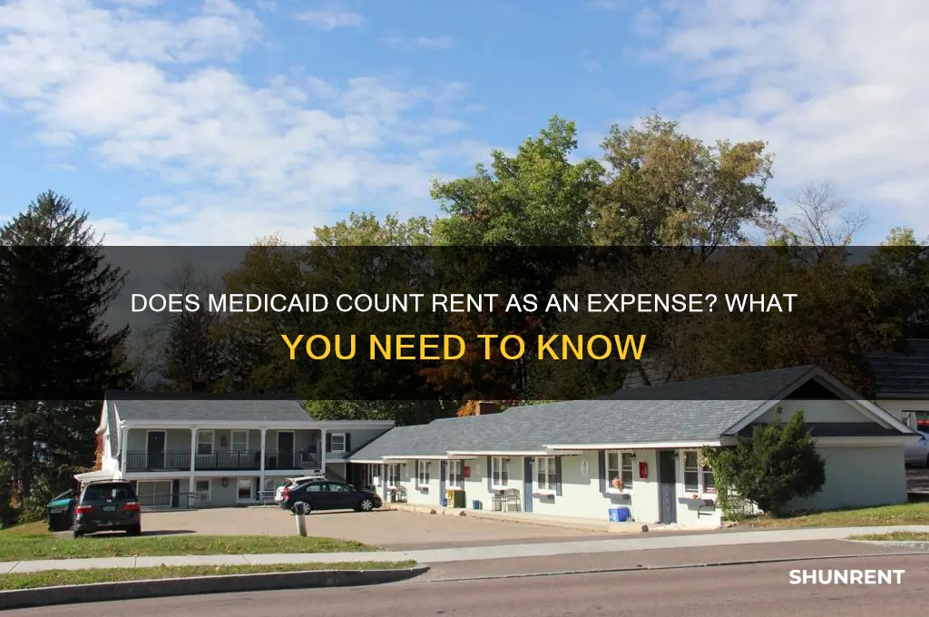 does medicad consider rent as an expense