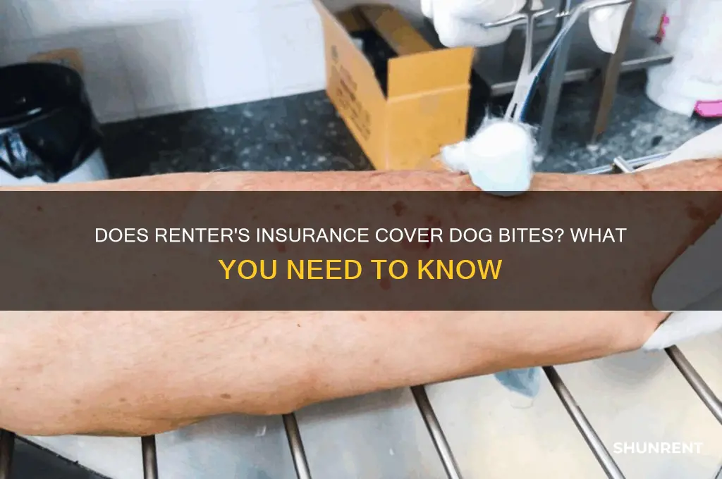 does renter