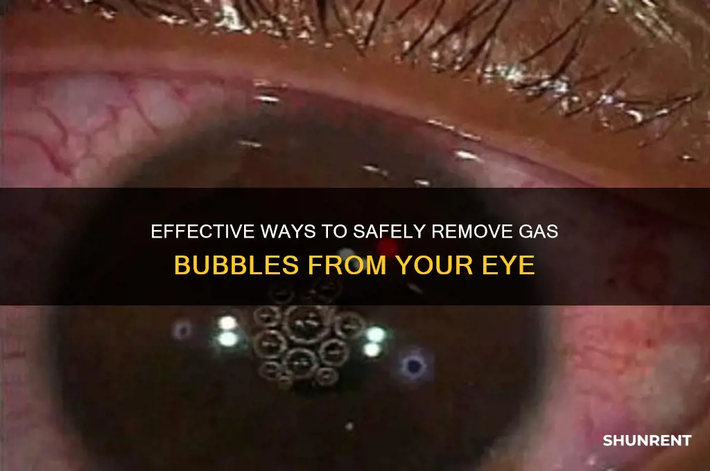 how to rent a gas out of your eye