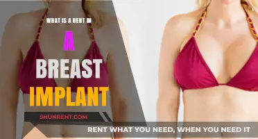 Understanding Breast Implant Rents: Causes, Risks, and Treatment Options