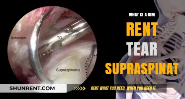 Understanding Rim Rent Tears: A Comprehensive Guide to Supraspinatus Injuries