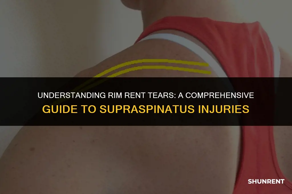 what is a rim rent tear supraspinatus