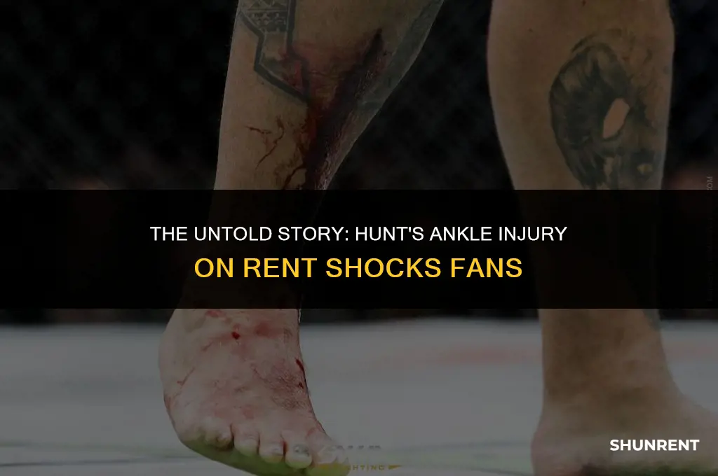 when did hunt on rent break ankle