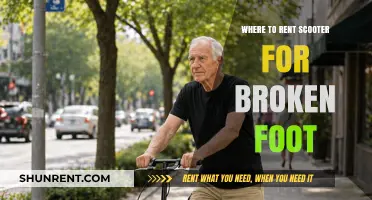 Scooter Rentals for Recovery: Top Picks for Broken Foot Support